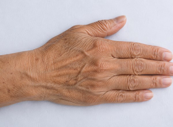 Anti-Aging Solutions